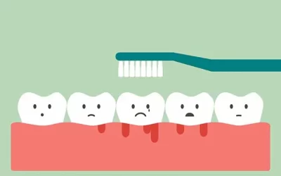 Gingivita, încotro?