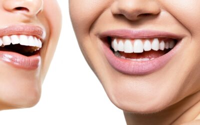 Cum să îmi păstrez dinții sănătoși? Pacienții întreabă, stomatologii răspund