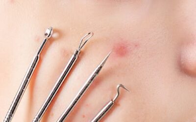 De vorbă cu tenul tău – 15 dintre cele mai frecvente modificări ale pielii pe care le observi în oglindă