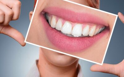 Când ar trebui să-mi fac griji cu privire la sângerarea gingiilor?